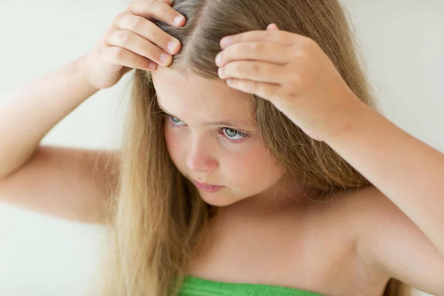 head lice treatment 1536x1026